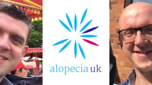 Ralph shares his experience with alopecia areata