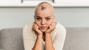 Reflections on an unexpectedly eventful week for Alopecia UK