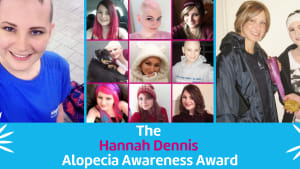 The Hannah Dennis Alopecia Awareness Award 2022