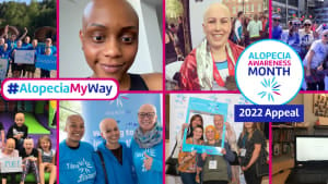 Alopecia; My Way - Get Involved This September!